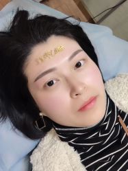 点击看大图 -郡艺医疗美容·微整·眼鼻吸脂