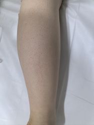 体验后-上海首尔丽格医疗美容医院