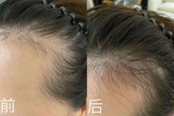 -SKINLALA美肤疗愈SPA