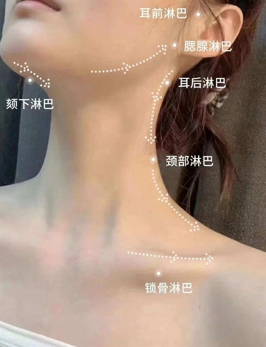 脸下巴变宽了 甲状腺开始出现问题了