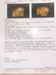 点击看大图 -潍坊艾玛妇产医院
