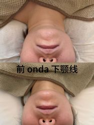 点击看大图 -栖SPA·ONDA ·美肤炫·海菲秀科技美肤中心