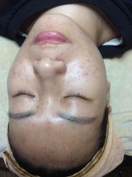 -瑶芳·痘院士专业祛痘·皮肤管理