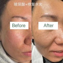 -LUNA皮相美·骨相美高级美感