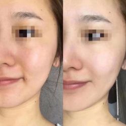 -LUNA皮相美·骨相美高级美感