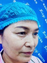 -郡艺医疗美容·微整·眼鼻吸脂