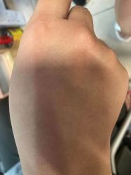 -痣斑堂·取大痣