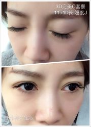睫毛嫁接-光SPA科技美肤