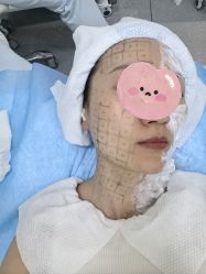 -agge蛋白医美