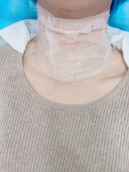 -agge蛋白医美