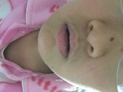 VIO维奥国际皮肤美容连锁机构-MedSkinCare科技祛痘肌肤修护中心