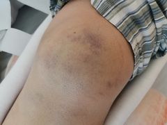 -上海交通大学医学院附属仁济医院(南院)