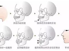 -团圆口腔·种植中心(锦江院区)