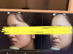-苑苑vbeauty科技美容SPA