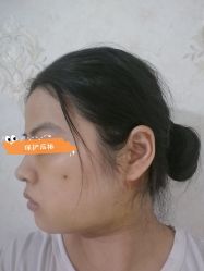 体验后-杭州医巢医疗美容