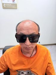 点击看大图 -唐风采假发补发定制