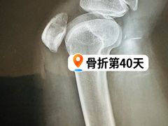 -中国人民解放军总医院