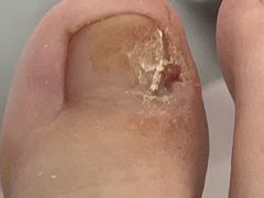 -郑远元专业修脚房·按摩·肉刺·灰指甲(东安路店)