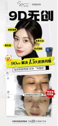-闺蜜美甲