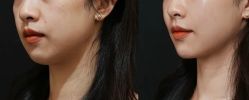 -Dr.U博士医疗美容医院