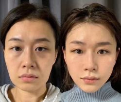-LUNA皮相美·骨相美高级美感
