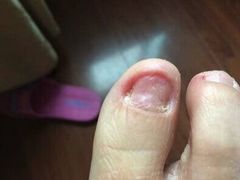 -新甲连锁灰指甲·甲沟炎·鸡眼(黑龙江路店)