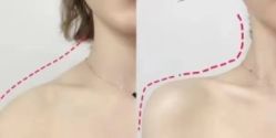 -上海漾颜医疗美容