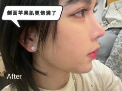-Yestar宁波艺星整形医院