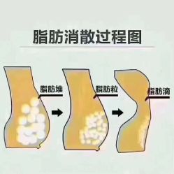-香薇妮丝女子减肥院