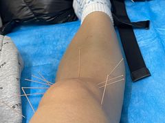 -中国中医科学院针灸医院