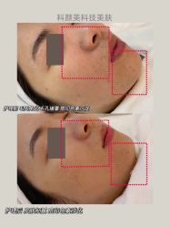 -美肤盾祛痘·问题肌头疗管理中心