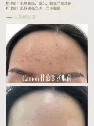 -佳慕·痘痘·问题肌管理中心