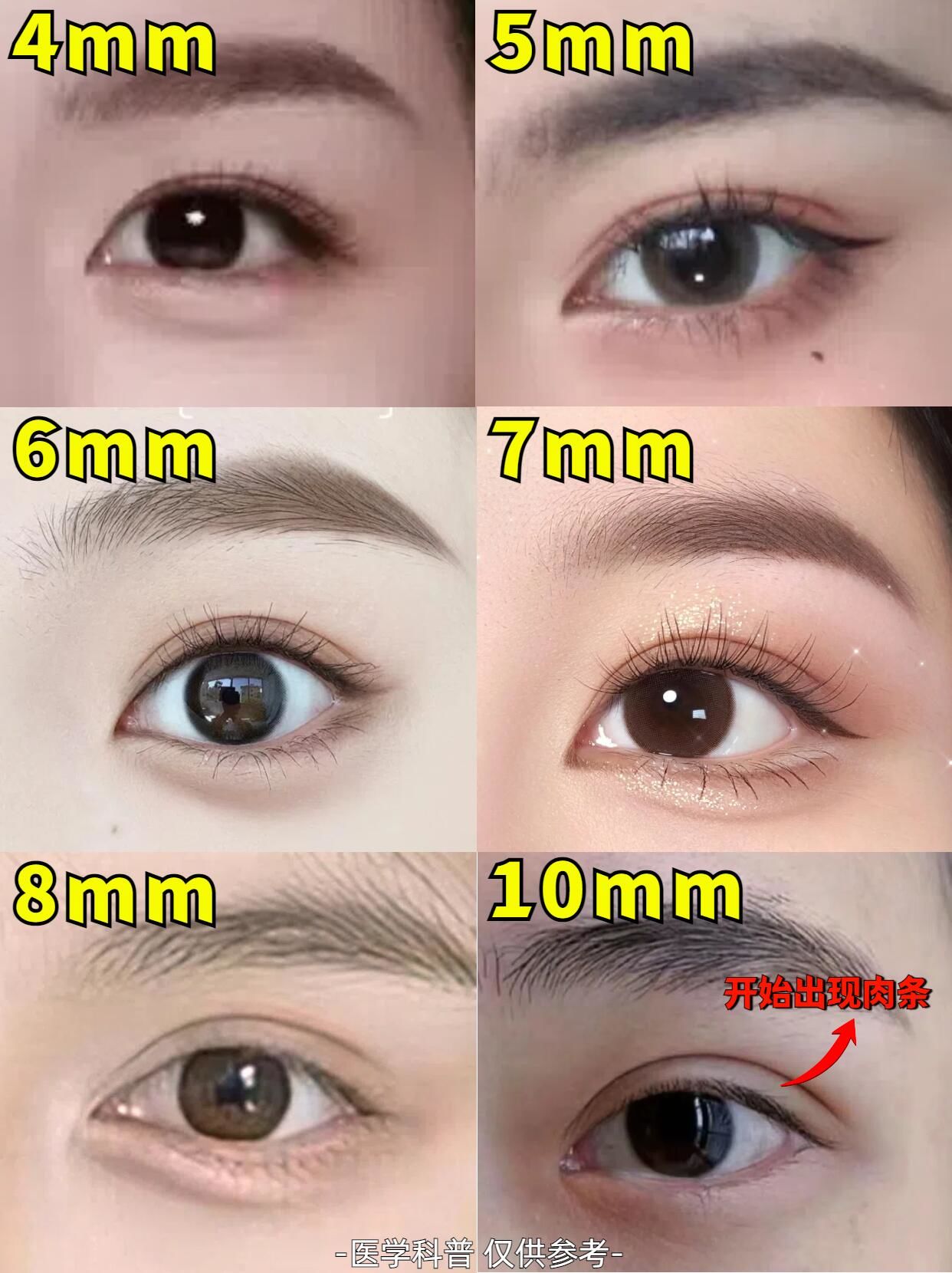 1分钟知道,你喜欢那种双眼皮宽度