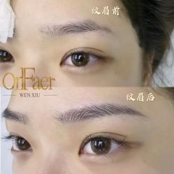 点击看大图 -OnFaer.纹眉半永久无创洗眉