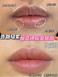 点击看大图 -西施无菌半永久纹绣眉眼影唇轻增发纹发际线