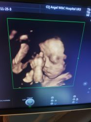 点击看大图 -重庆安琪儿妇产医院-妇幼保健联盟医院