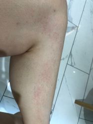 -广东韩妃整形外科医院