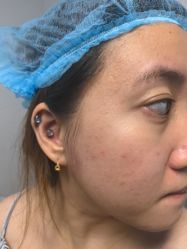 -安徽合肥韩美整形外科医院