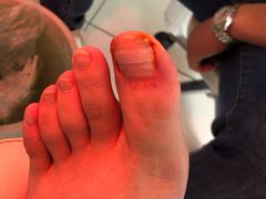 -新甲连锁灰指甲·甲沟炎·鸡眼(黑龙江路店)