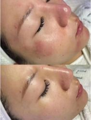 -LUNA皮相美·骨相美高级美感