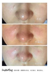 光SPA水氧＋opt-光SPA科技美肤