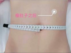 -Lily纤美·科技减脂中心