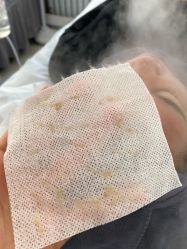 -瑶芳清颜草本祛痘