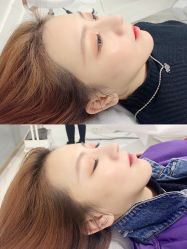 -OnFaer.纹眉半永久无创洗眉