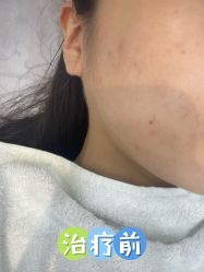 体验前-Yestar 嘉兴艺星医疗美容医院