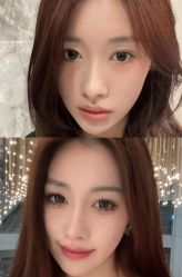 -Yestar艺星医疗美容医院