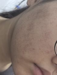 -Yestar宁波艺星整形医院