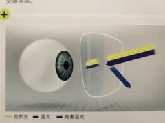-宝岛眼镜(北京亚运村旗舰店)