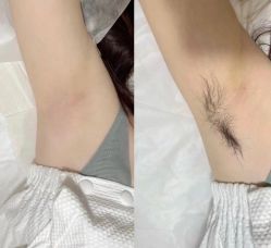 -MUSES专业脱毛比基尼サロン日式连锁