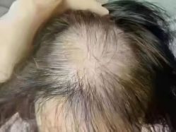 -诗碧曼养发